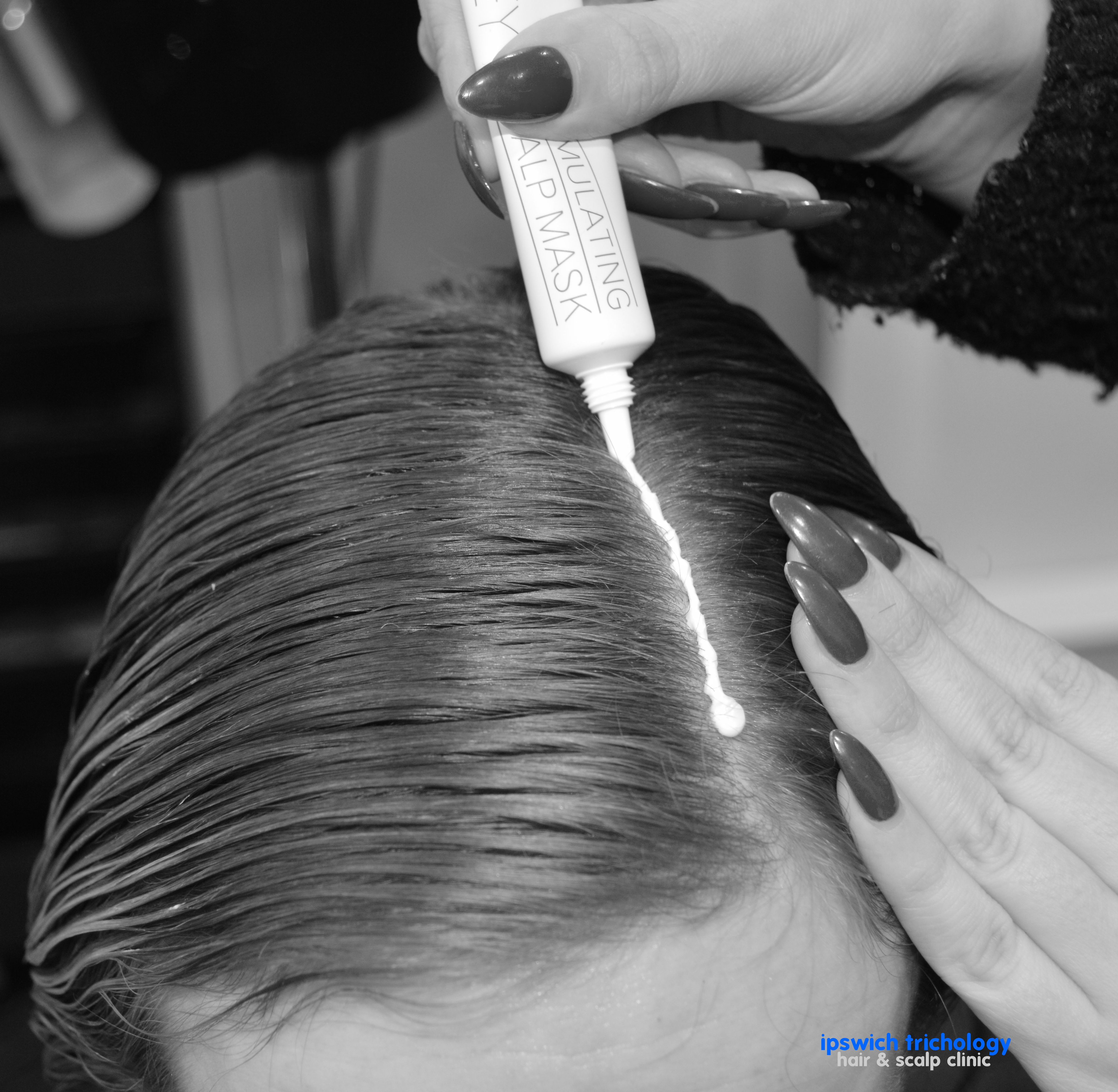 Ipswich Trichology Hair & Scalp Clinic – Hair Loss & Scalp Clinic in Suffolk