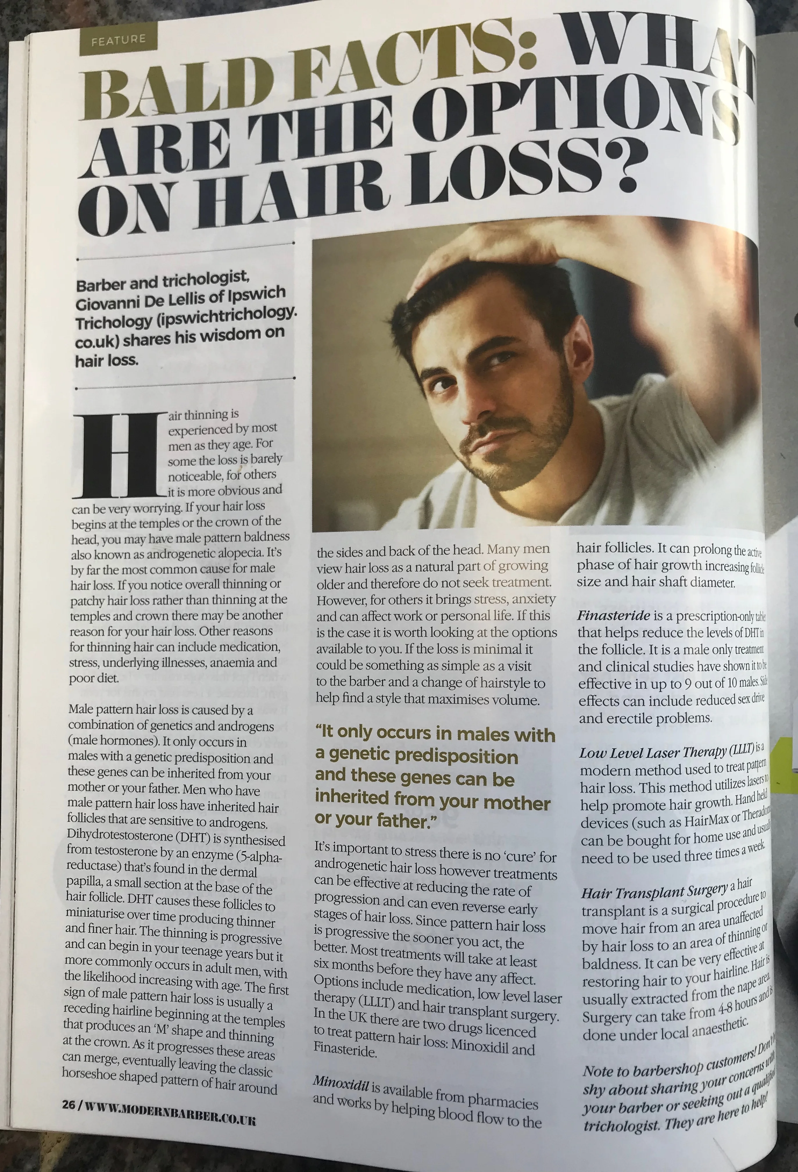 Bald Facts: What are the options on hair loss? Article by Giovanni De Lellis